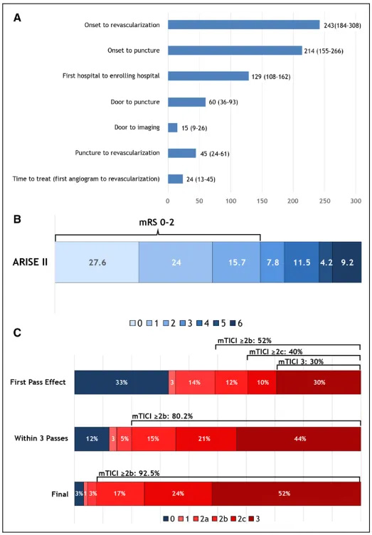 Resultados Primários do Estudo Multicêntrico ARISE II (Análise de Revascularização em Acidente Vascular Isquêmico com EmboTrap