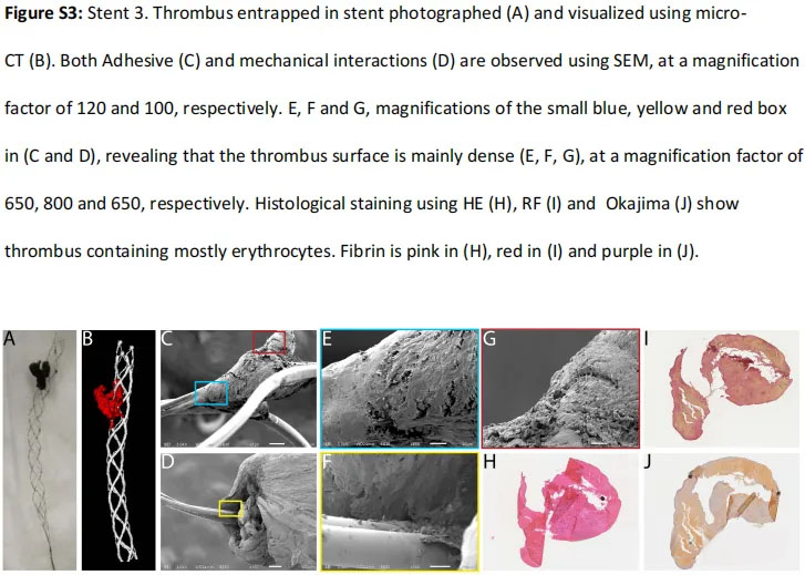 stents de tromboectomia